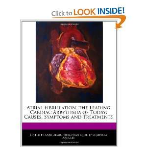  Atrial Fibrillation, the Leading Cardiac Arrythmia of 